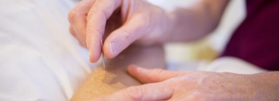 Acupunctuur bij Raynaud, ziekte van Raynaud: kan één naaldje de klachten verminderen